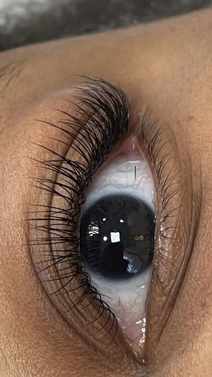 Lash line on a dark iris